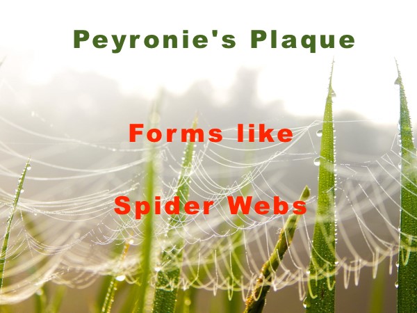 pictures-penile-plaque